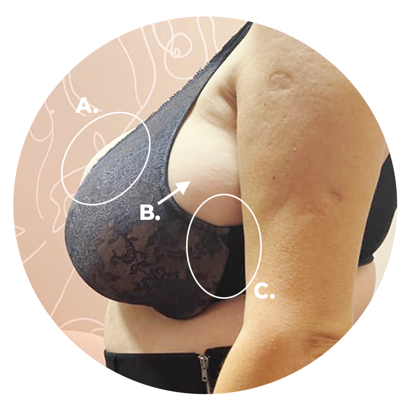 I'm a bra expert - signs that you have quad-boob from your big