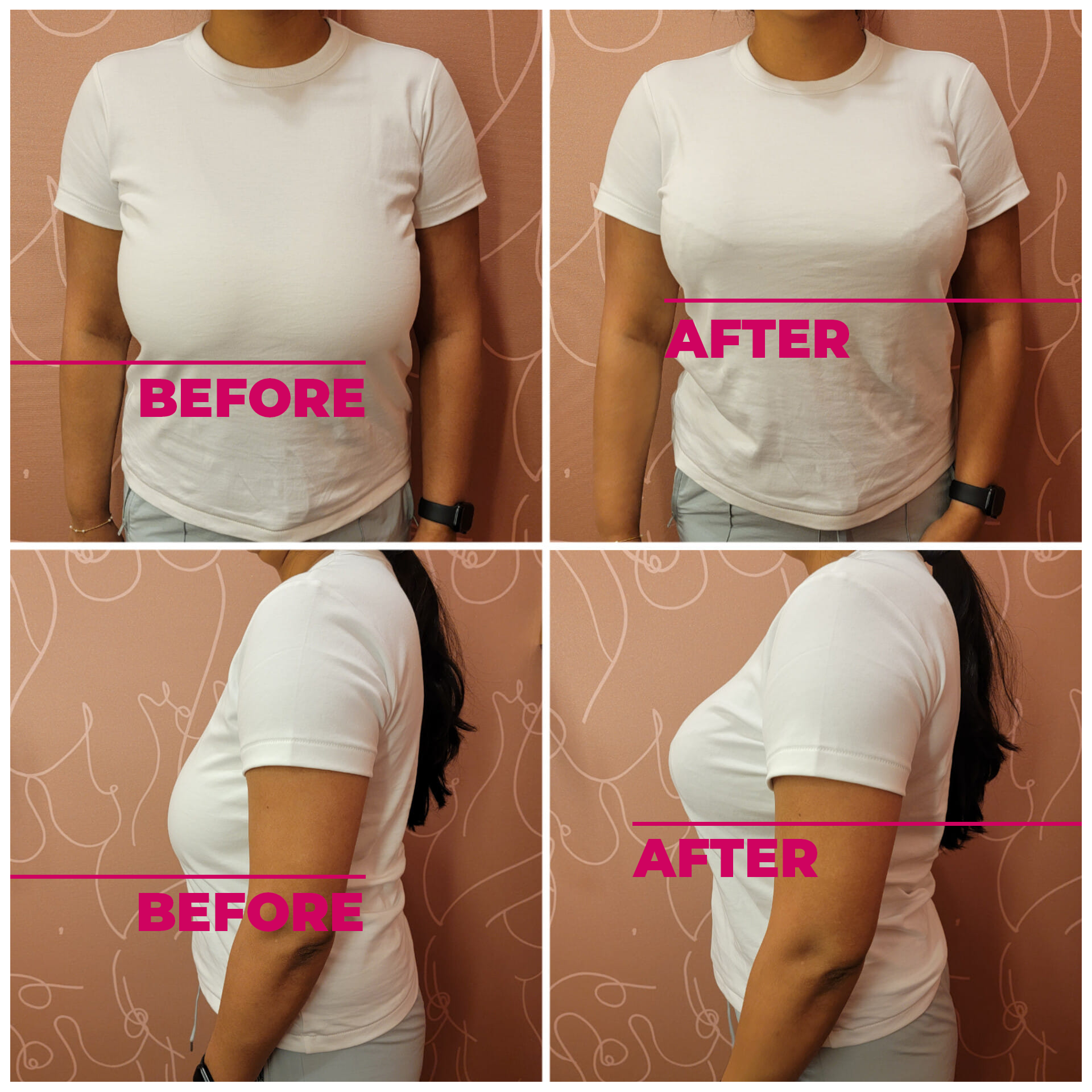 BEFORE AFTER WITH TSHIRT